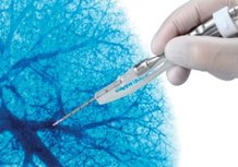 biolitec_R_laser_fiber_with_handpiece_for_thoracic_surgery___c__biolitec_R___Detail