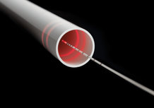 Light_rings_of_ELVeS_R__Radial_R__2ring_laser_fibre_of_biolitec_R__web___c__biolitec_R__