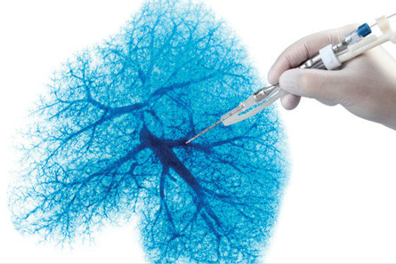 biolitec_R_laser_fiber_with_handpiece_for_thoracic_surgery___c__biolitec_R__